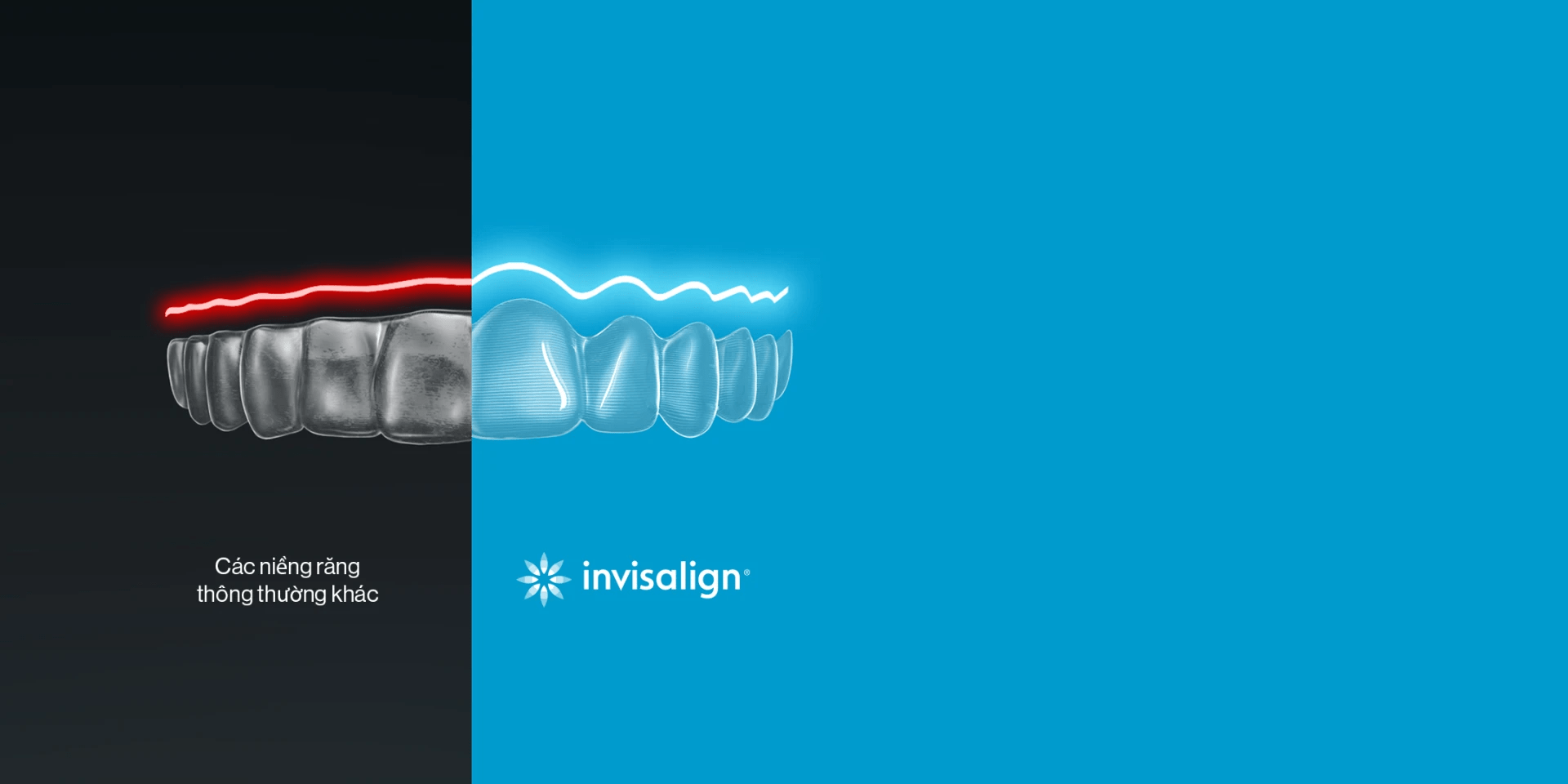 Niềng răng Invisalign có tốt không? Giải đáp thắc mắc