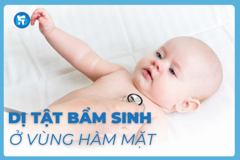 Dị tật bẩm sinh ở vùng hàm mặt