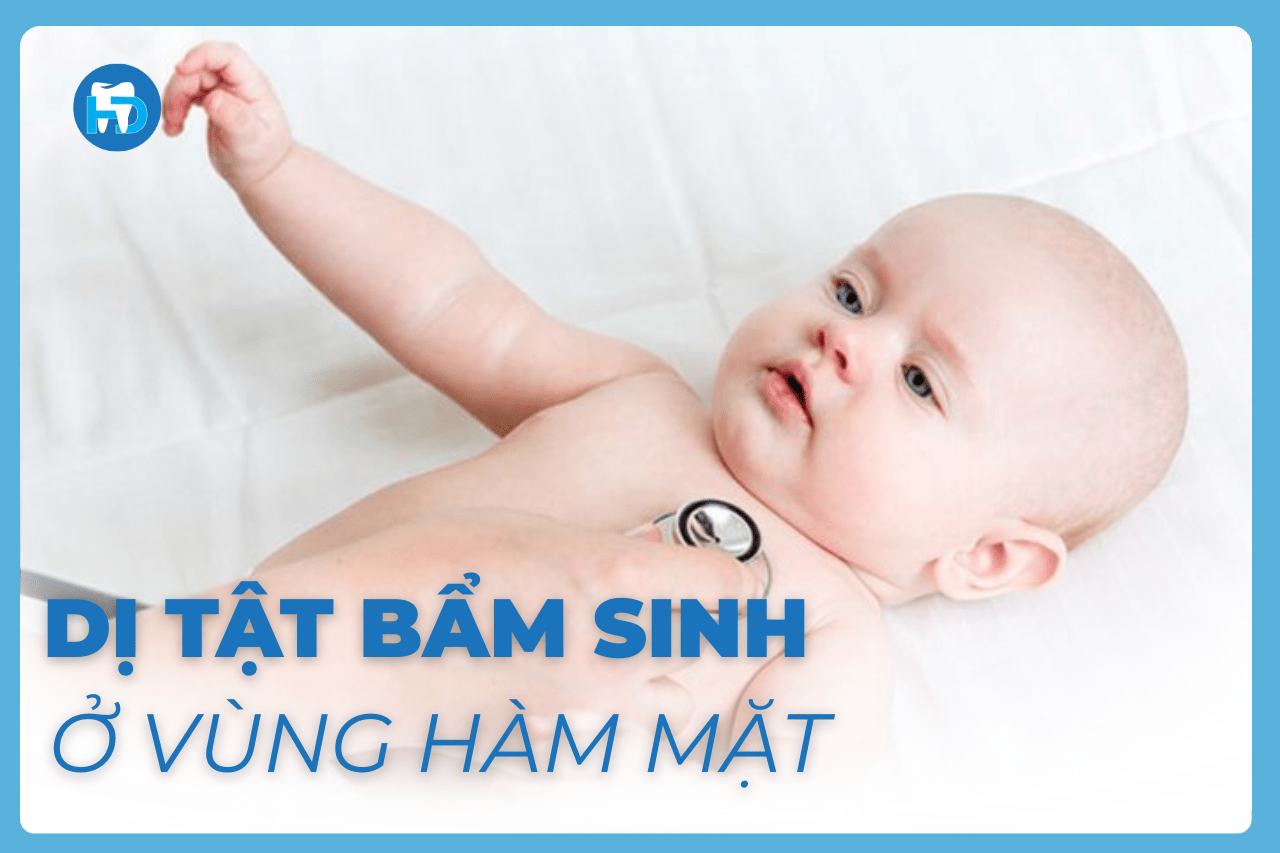 Dị tật bẩm sinh ở vùng hàm mặt