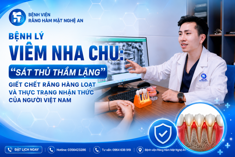 Bệnh lý viêm nha chu