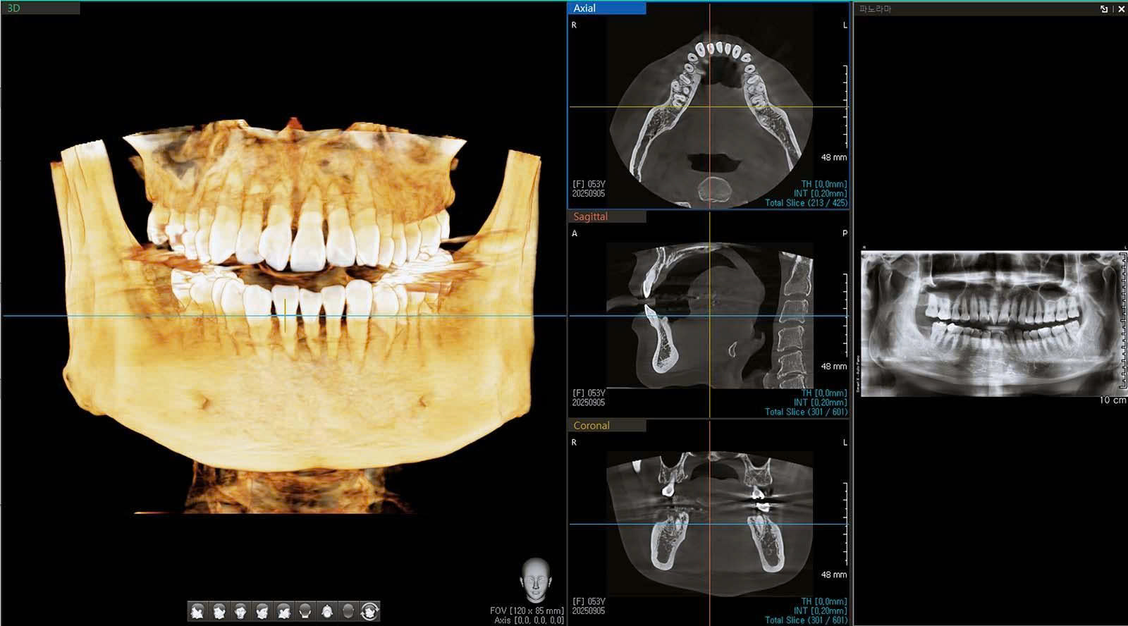 Hình ảnh 3 chiều (3D) 