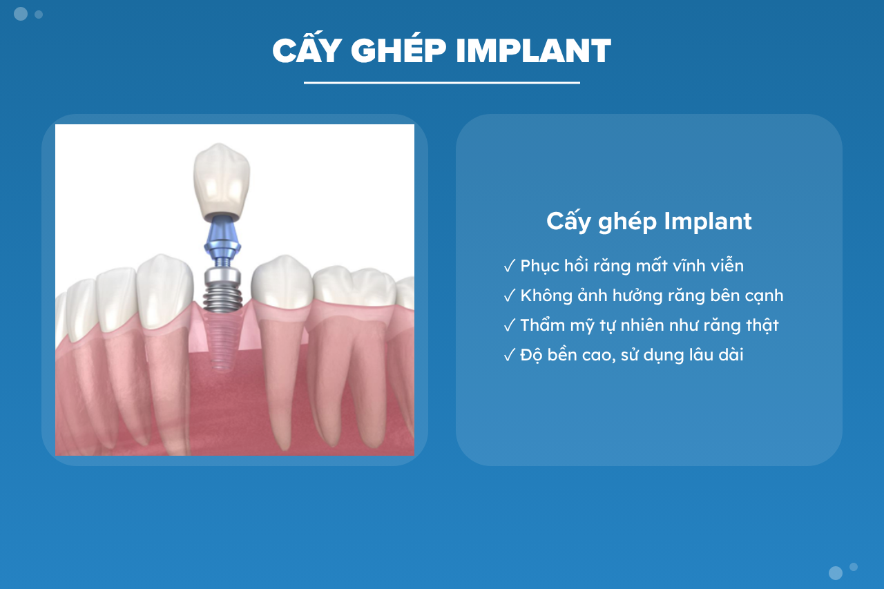 Cấy ghép Implant