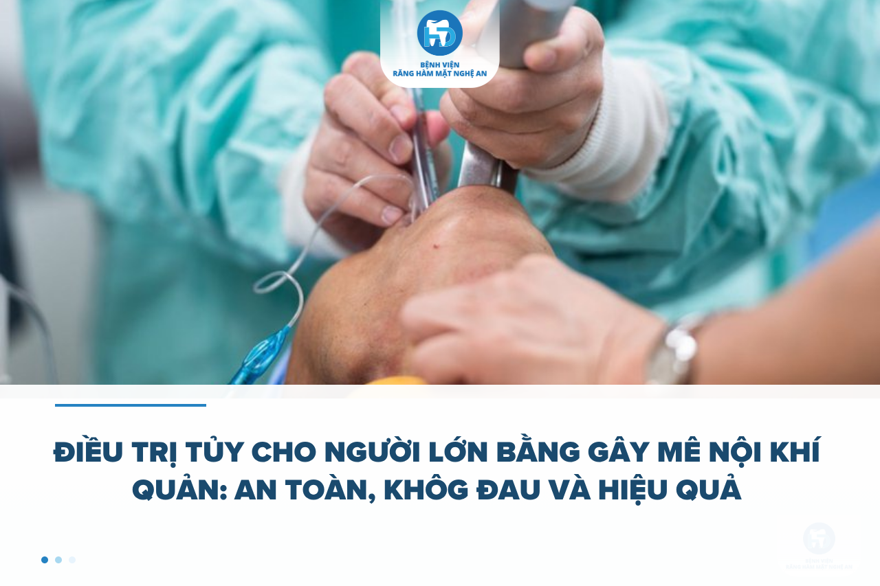 Điều trị tủy cho người lớn bằng gây mê nội khí quản an toàn, không đau và hiệu quả