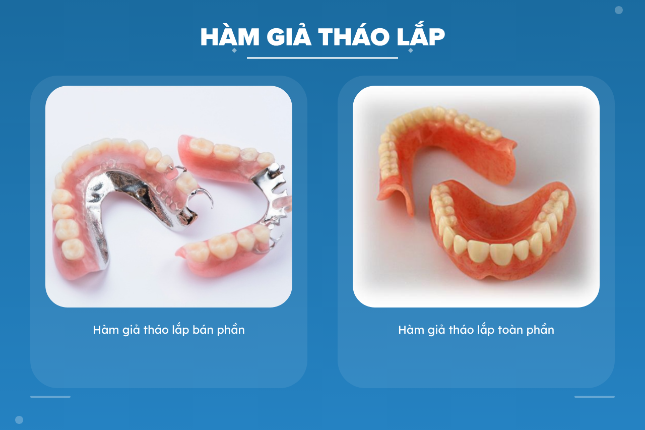 Hàm giả tháo lắp