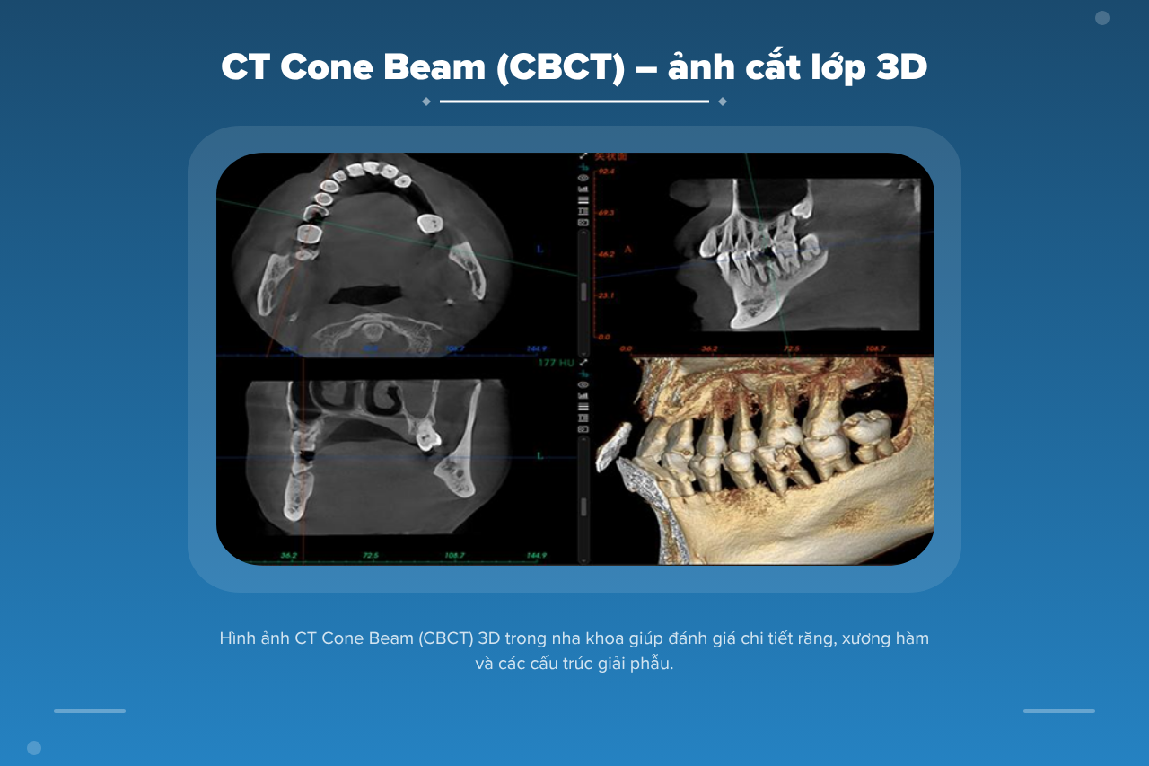 Hình ảnh CT Cone Beam (CBCT) 3D trong nha khoa giúp đánh giá chi tiết răng, xương hàm và các cấu trúc giải phẫu.
